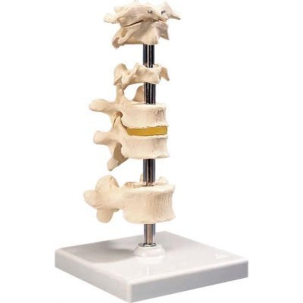 3B® Anatomical Model - 6 Mounted Vertebrae with Removable Stand, Fabrication Enterprises, Mfr#: 983935