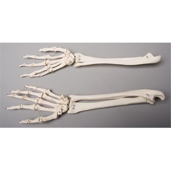 Skeletons and More SM372DL Left Forearm, Skeletons And More, Mfr#: SM372DL
